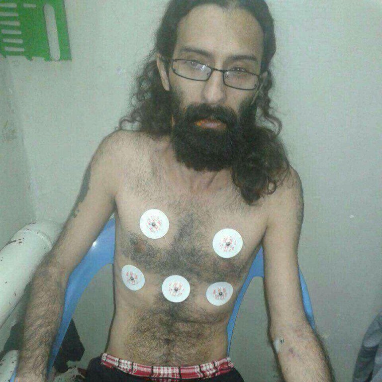 Saeed Shirzad has been hospitalized in critical condition after more than 35 days on hunger strike.